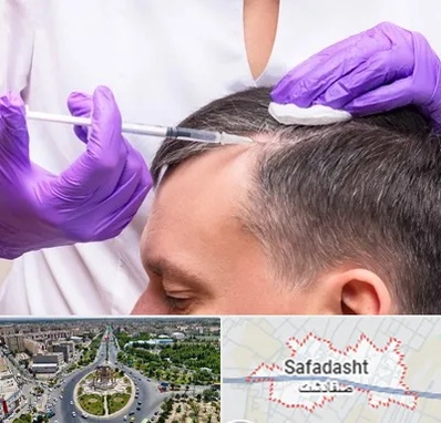 دکتر فوق تخصص پوست و مو در صفادشت