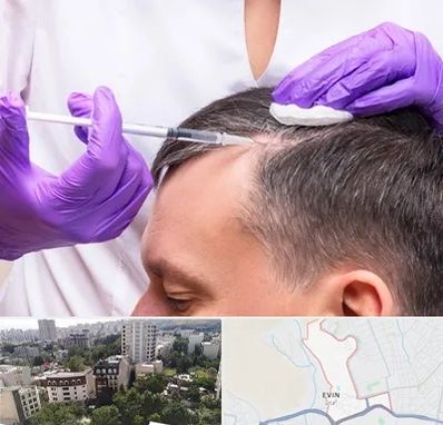 دکتر فوق تخصص پوست و مو در اوین