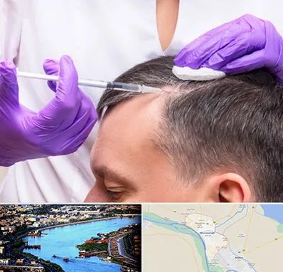 دکتر فوق تخصص پوست و مو در خرمشهر