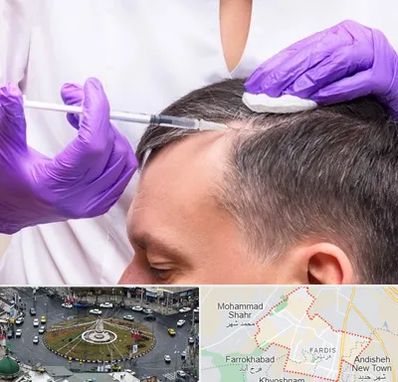 دکتر فوق تخصص پوست و مو در فردیس کرج 