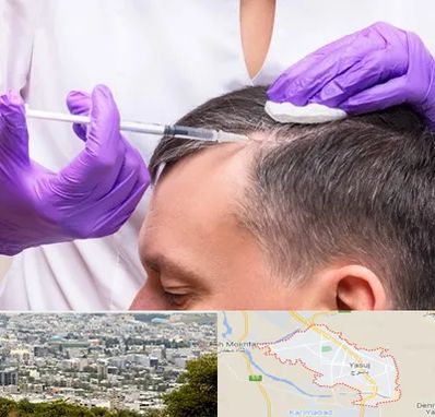 دکتر فوق تخصص پوست و مو در یاسوج