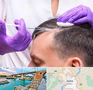 دکتر فوق تخصص پوست و مو در دزفول