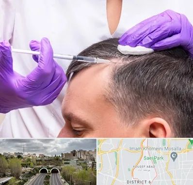 دکتر فوق تخصص پوست و مو در یوسف آباد 