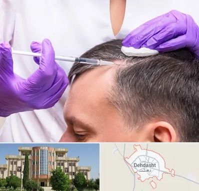 دکتر فوق تخصص پوست و مو در دهدشت