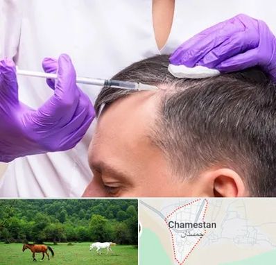 دکتر فوق تخصص پوست و مو در چمستان