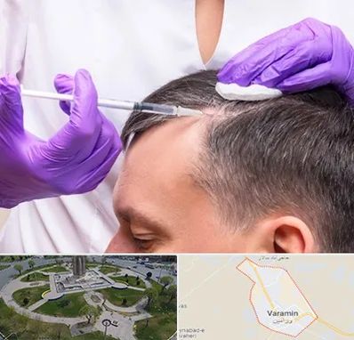 دکتر فوق تخصص پوست و مو در ورامین