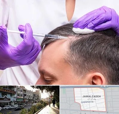 دکتر فوق تخصص پوست و مو در خیابان جمالزاده