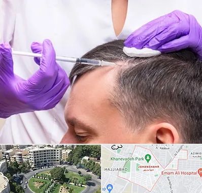 دکتر فوق تخصص پوست و مو در جهانشهر کرج 