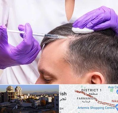 دکتر فوق تخصص پوست و مو در فرمانیه 