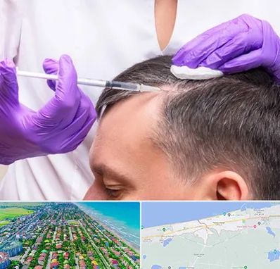 دکتر فوق تخصص پوست و مو در فریدونکنار