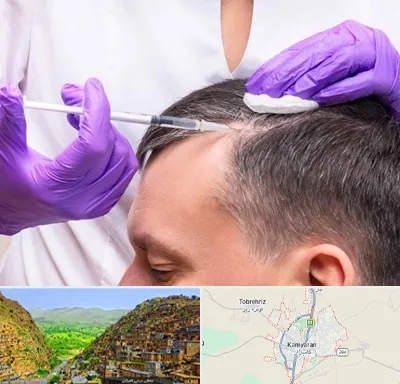 دکتر فوق تخصص پوست و مو در کامیاران