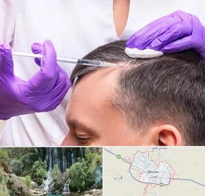 دکتر فوق تخصص پوست و مو در شیروان