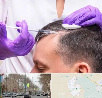 دکتر فوق تخصص پوست و مو در نظرآباد کرج 