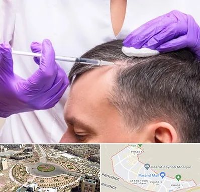 دکتر فوق تخصص پوست و مو در پرند