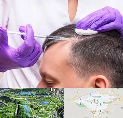 دکتر فوق تخصص پوست و مو در بجنورد