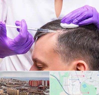 دکتر فوق تخصص پوست و مو در سهند تبریز