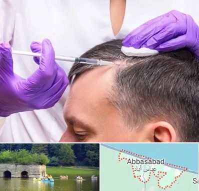 دکتر فوق تخصص پوست و مو در عباس آباد