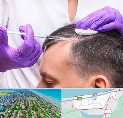 دکتر فوق تخصص پوست و مو در نور