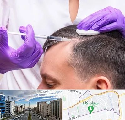 دکتر فوق تخصص پوست و مو در سعادت آباد 