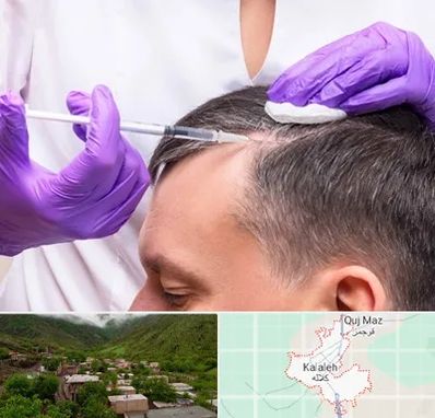 دکتر فوق تخصص پوست و مو در کلاله