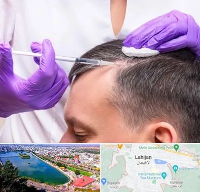 دکتر فوق تخصص پوست و مو در لاهیجان