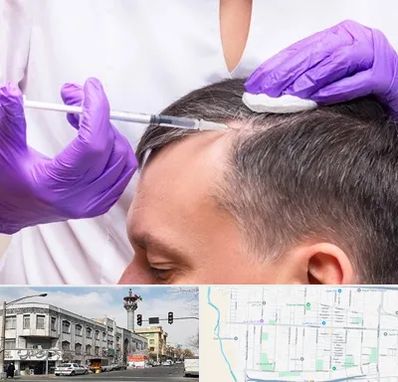 دکتر فوق تخصص پوست و مو در 17شهریور