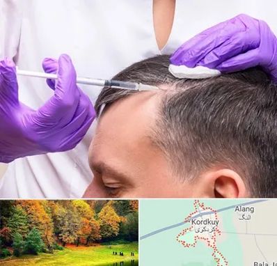 دکتر فوق تخصص پوست و مو در کردکوی