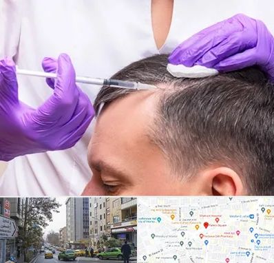 دکتر فوق تخصص پوست و مو در فاطمی 