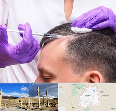 دکتر فوق تخصص پوست و مو در مرودشت