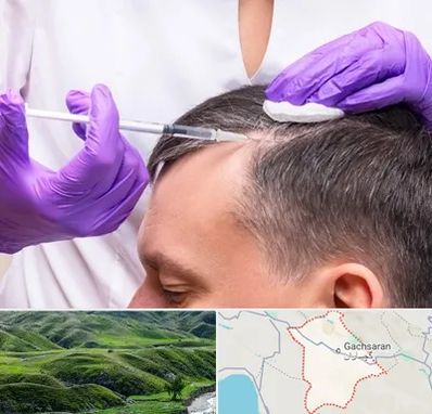 دکتر فوق تخصص پوست و مو در گچساران
