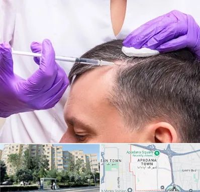 دکتر فوق تخصص پوست و مو در آپادانا