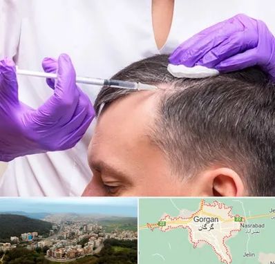 دکتر فوق تخصص پوست و مو در گرگان