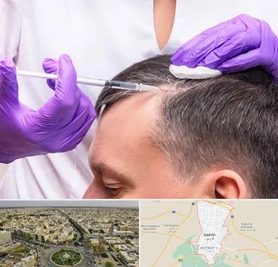 دکتر فوق تخصص پوست و مو در قزوین