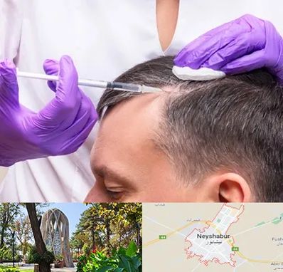 دکتر فوق تخصص پوست و مو در نیشابور