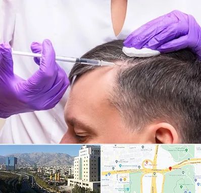 دکتر فوق تخصص پوست و مو در حقانی 