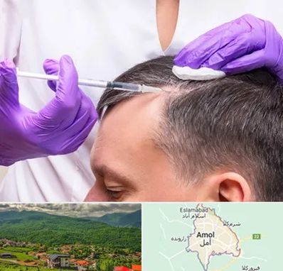 دکتر فوق تخصص پوست و مو در آمل