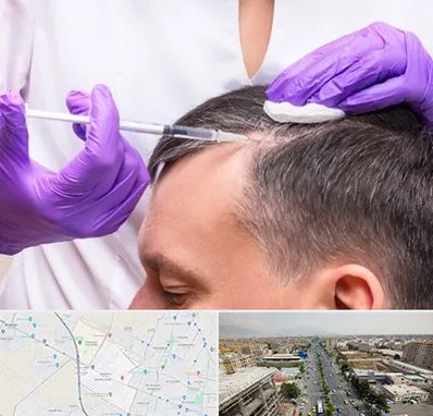 دکتر فوق تخصص پوست و مو در حصارک کرج 