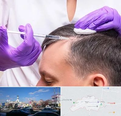 دکتر فوق تخصص پوست و مو در ماهدشت کرج 