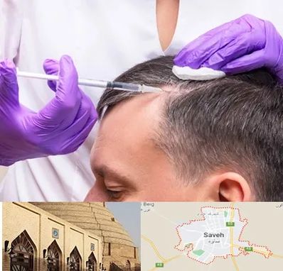 دکتر فوق تخصص پوست و مو در ساوه