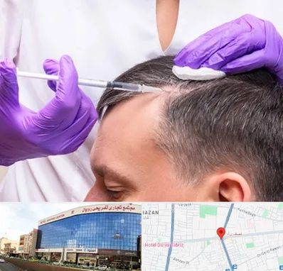 دکتر فوق تخصص پوست و مو در نصف راه تبریز