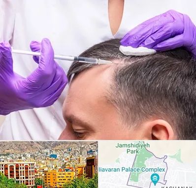 دکتر فوق تخصص پوست و مو در نیاوران 