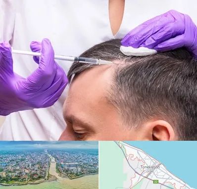 دکتر فوق تخصص پوست و مو در تنکابن