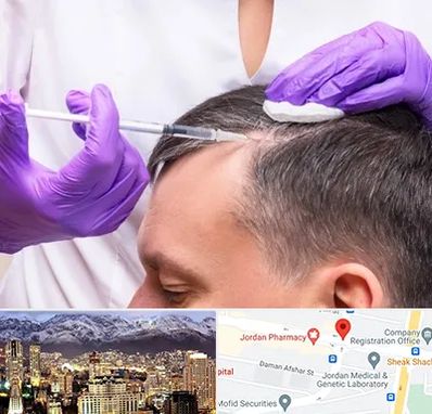 دکتر فوق تخصص پوست و مو در جردن 