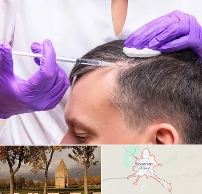 دکتر فوق تخصص پوست و مو در تویسرکان