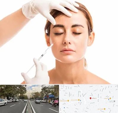 تزریق ژل گونه در دولت