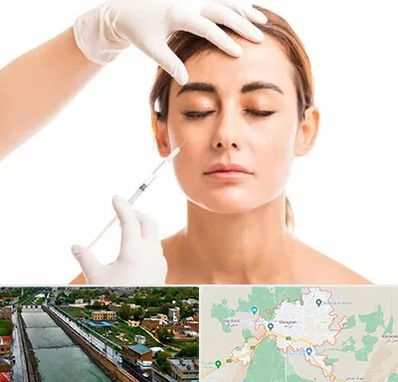 تزریق ژل گونه در مراغه