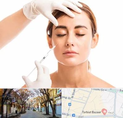 تزریق ژل گونه در تربیت تبریز