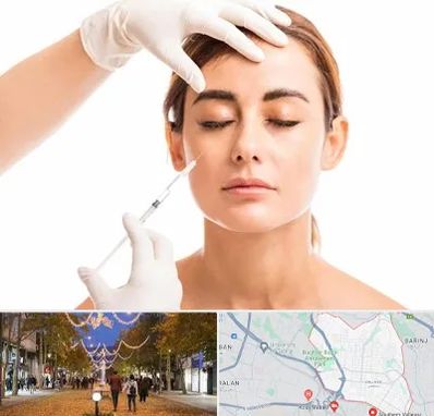 تزریق ژل گونه در ولیعصر ارومیه