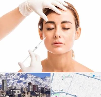 تزریق ژل گونه در ازگل