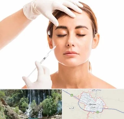 تزریق ژل گونه در شیروان